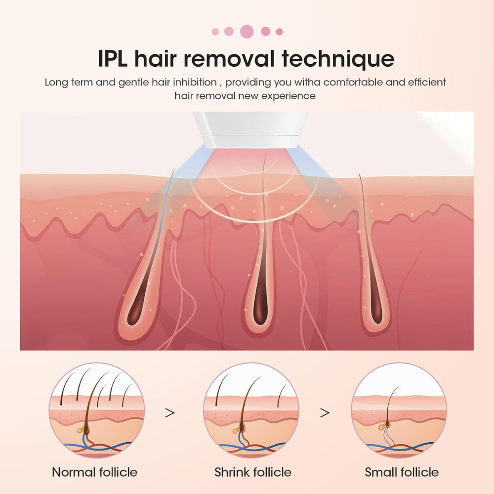 Mini Ipl Laser Epilator | Portable Permanent Hair Removal Device